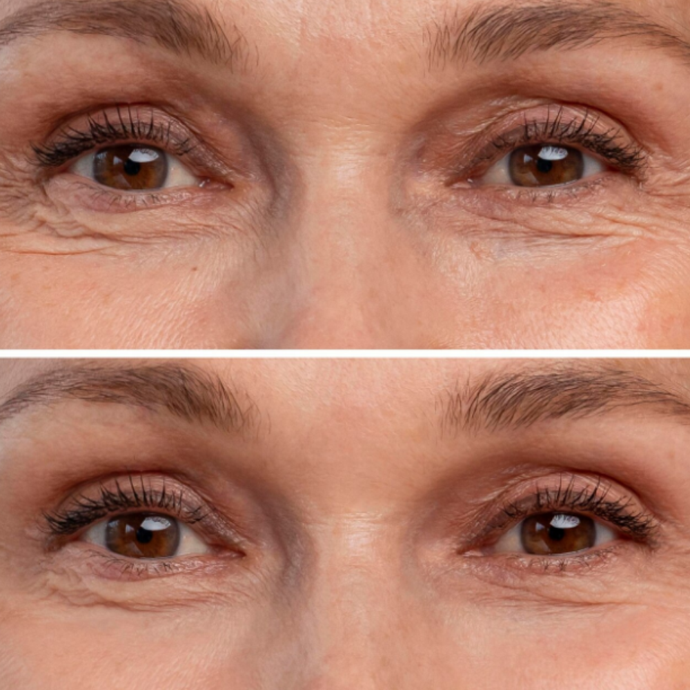 anti_envelhecimento2